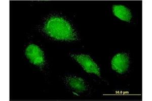 Image no. 1 for anti-alpha 1 Microglobulin/bikunin precursor (AMBP) (AA 19-353) antibody (ABIN598537) (AMBP Antikörper  (AA 19-353))
