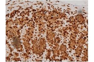 ABIN6256714 and ABIN6267384 at 1/200 staining Rat ganstric tissue sections by IHC-P. (Ezrin Antikörper  (pTyr353, pTyr354))