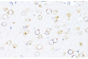 Immunohistochemistry of paraffin-embedded Rat brain using DNAJB11 Polyclonal Antibody at dilution of 1:100 (40x lens). (DNAJB11 Antikörper)