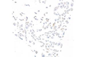 Immunocytochemistry (ICC) image for anti-Dipeptidyl-Peptidase 4 (DPP4) (AA 29-766) antibody (ABIN7795691)