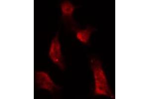 ABIN6267677 staining NIH-3T3 by IF/ICC. (ATRIP Antikörper  (pSer68))