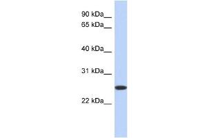 BLVRB antibody used at 1 ug/ml to detect target protein. (BLVRB Antikörper  (Middle Region))