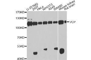Western blot analysis of extracts of various cell lines, using VCP antibody. (VCP Antikörper)