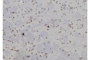 ABIN6266276 and ABIN6277441 at 1/100 staining Rat brain tissue by IHC-P. (SUMO4 Antikörper  (Internal Region))