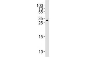 Western Blotting (WB) image for anti-Growth Differentiation Factor 15 (GDF15) (C-Term) antibody (ABIN3028689)