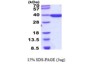 SDS-PAGE (SDS) image for Aldo-Keto Reductase Family 1, Member D1 (AKR1D1) (AA 1-326) protein (ABIN5854502) (AKR1D1 Protein (AA 1-326))