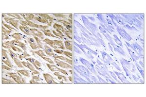 Immunohistochemistry analysis of paraffin-embedded human heart tissue using MRPL39 antibody. (MRPL39 Antikörper  (C-Term))