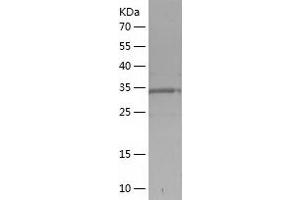 Western Blotting (WB) image for Dipeptidase 1 (Renal) (DPEP1) (AA 263-388) protein (His-IF2DI Tag) (ABIN7122672) (DPEP1 Protein (AA 263-388) (His-IF2DI Tag))