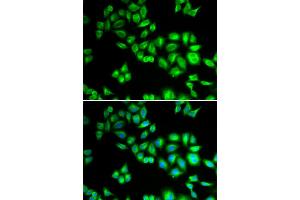 Immunofluorescence analysis of HeLa cells using CUL1 antibody. (Cullin 1 Antikörper)