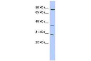 Image no. 1 for anti-Kelch-Like 5 (KLHL5) (C-Term) antibody (ABIN6742832)
