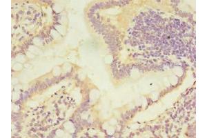 Immunohistochemistry of paraffin-embedded human small intestine tissue using ABIN7146755 at dilution of 1:100 (CMBL Antikörper  (AA 2-245))