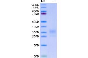 Biotinylated Human LAIR1 on Tris-Bis PAGE under reduced condition. (LAIR1 Protein (AA 22-163) (His-Avi Tag,Biotin))
