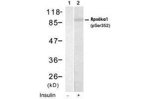 Western blot analysis of extract from HUVEC cells using Rps6ka1 (phospho S352) polyclonal antibody (Cat # PAB12168, Lane 1 and 2). (RPS6KA1 Antikörper  (pSer352))