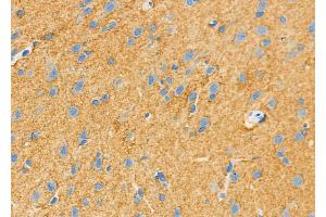 ABIN6262047 and ABIN6279612 at 1/100 staining Rat brain tissue by IHC-P.
