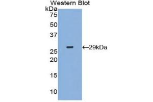 Western blot analysis of the recombinant protein. (MAP4K5 Antikörper  (AA 9-231))