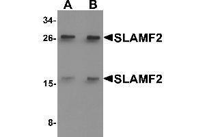Western blot analysis of SLAMF2 in rat lung tissue lysate with SLAMF2 antibody at (A) 1 and (B) 2 µg/mL. (CD48 Antikörper  (Middle Region))
