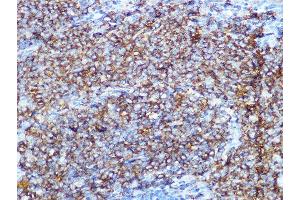 Immunohistochemistry of paraffin-embedded rat spleen using CD79B Rabbit mAb (ABIN1682474, ABIN3018855, ABIN3018856 and ABIN7101674) at dilution of 1:100 (40x lens). (CD79b Antikörper)