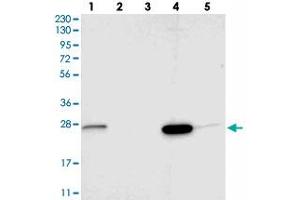 Western blot analysis of Lane 1: RT-4, Lane 2: U-251 MG, Lane 3: Human Plasma, Lane 4: Liver, Lane 5: Tonsil with SIGMAR1 polyclonal antibody . (SIGMAR1 Antikörper)