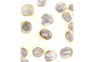 Immunocytochemical staining of DAXX in HeLa cells with DAXX antibody at 10μg/ml. (DAXX Antikörper)