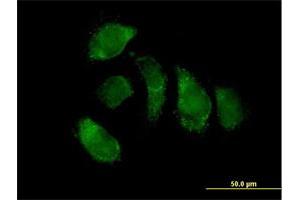 Immunofluorescence of purified MaxPab antibody to EHHADH on HeLa cell. (EHHADH Antikörper  (AA 1-723))