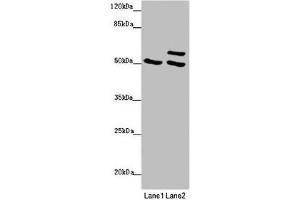 Western blot All lanes: TUBB4A antibody at 2 μg/mL Lane 1: 293T whole cell lysate Lane 2: Hela whole cell lysate Secondary Goat polyclonal to rabbit IgG at 1/10000 dilution Predicted band size: 50 kDa Observed band size: 50, 58 kDa (TUBB4 Antikörper  (AA 1-444))