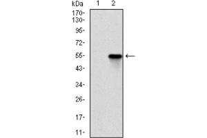 Western Blotting (WB) image for anti-rho-Associated, Coiled-Coil Containing Protein Kinase 1 (ROCK1) antibody (ABIN1846125) (ROCK1 Antikörper)