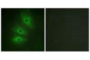 Immunofluorescence analysis of HeLa cells, using ADCY5/6 antibody. (ADCY6 Antikörper)