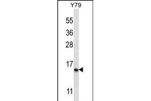 NR2C2 Antibody (N-term) 12673a western blot analysis in Y79 cell line lysates (35 μg/lane). (NR2C2AP Antikörper  (N-Term))