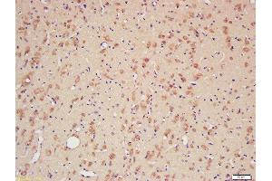 Formalin-fixed and paraffin embedded rat brain labeled with Rabbit Anti-CYPA Polyclonal Antibody, Unconjugated (ABIN759716) at 1:200 followed by conjugation to the secondary antibody and DAB staining (PPIA Antikörper  (AA 101-165))