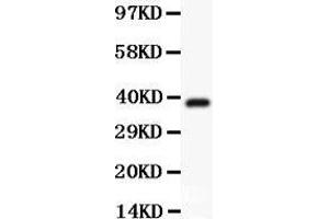 Anti-Hamartin Picoband antibody,  All lanes: Anti Hamartin  at 0. (TSC1 Antikörper  (AA 686-884))
