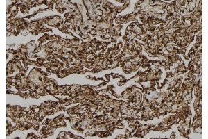 ABIN6278874 at 1/100 staining Human lung tissue by IHC-P. (CARD18 Antikörper  (C-Term))