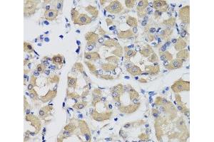 Immunohistochemistry of paraffin-embedded Human stomach using PSPH Polyclonal Antibody at dilution of 1:100 (40x lens). (PSPH Antikörper)