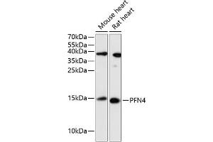 Western blot analysis of extracts of various cell lines, using PFN4 antibody (ABIN6129663, ABIN6145495, ABIN6145496 and ABIN6217780) at 1:3000 dilution. (Profilin 4 Antikörper  (AA 1-129))