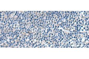 Immunohistochemistry of paraffin-embedded Human tonsil tissue using KIF2A Polyclonal Antibody at dilution of 1:65(x200) (KIF2A Antikörper)