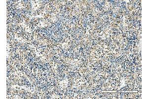 IHC analysis of IMPDH1 using anti-IMPDH1 antibody (ABIN7599864). (IMPDH1 Antikörper  (AA 123-500))