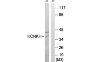 Western Blotting (WB) image for anti-Potassium Channel, Subfamily K, Member 17 (KCNK17) (AA 271-320) antibody (ABIN2890517) (KCNK17 Antikörper  (AA 271-320))