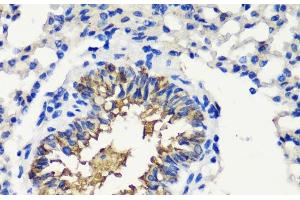 Immunohistochemistry of paraffin-embedded Mouse lung using FKBP1A Polyclonal Antibody at dilution of 1:200 (40x lens). (FKBP1A Antikörper)