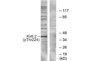 Western blot analysis of extracts from HeLa cells, using Kir6. (KCNJ11 Antikörper  (pThr224))
