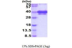 SDS-PAGE (SDS) image for Tumor Necrosis Factor Receptor Superfamily, Member 12A (TNFRSF12A) (AA 28-80) protein (hIgG-His-tag) (ABIN5854938)
