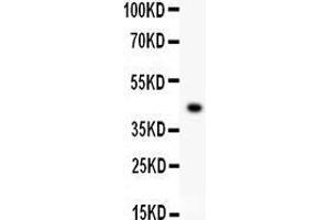 Anti- EDA antibody, Western blotting All lanes: Anti EDA  at 0. (Ectodysplasin A Antikörper  (AA 30-391))