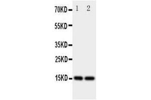 Western Blotting (WB) image for anti-Fatty Acid Binding Protein 5 (Psoriasis-Associated) (FABP5) (AA 10-23), (N-Term) antibody (ABIN3044084)
