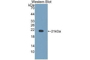 Detection of Recombinant CD164, Rat using Polyclonal Antibody to Cluster Of Differentiation 164 (CD164) (CD164 Antikörper  (AA 24-160))
