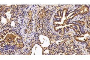 Immunohistochemistry (IHC) image for anti-Coagulation Factor VIII (F8) (AA 2253-2346) antibody (ABIN7434263)