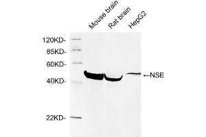 Western blot analysis of cell and tissue lysates using 1 µg/mL Rabbit Anti-NSE Polyclonal Antibody (ABIN398879) The signal was developed with IRDyeTM 800 Conjugated Goat Anti-Rabbit IgG.