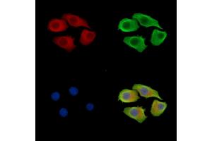 ABIN7095965 and ABIN7100027 staining Hela cells by IF/ICC. (SNX12 Antikörper)
