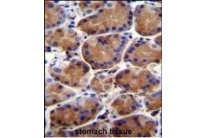 LRWD1 Antibody (N-term) (ABIN655752 and ABIN2845196) immunohistochemistry analysis in formalin fixed and paraffin embedded human stomach tissue followed by peroxidase conjugation of the secondary antibody and DAB staining.