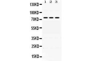 Western blot analysis of ACSL1 expression in rat liver extract ( Lane 1) HEPA whole cell lysates ( Lane 2) and A549 whole cell lysates ( Lane 3).