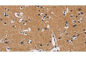 Immunohistochemistry of paraffin-embedded Human brain tissue using CBY1 Polyclonal Antibody at dilution 1:60 (CBY1/PGEA1 Antikörper)