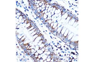 Immunohistochemistry of paraffin-embedded Human colon using CTGF Rabbit pAb (ABIN6127717, ABIN6139188, ABIN6139191 and ABIN6215222) at dilution of 1:100 (40x lens). (CTGF Antikörper  (AA 27-349))