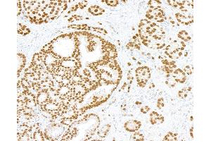 Immunohistochemistry (IHC) image for anti-Androgen Receptor (AR) (AA 1-50) antibody (ABIN7795785)